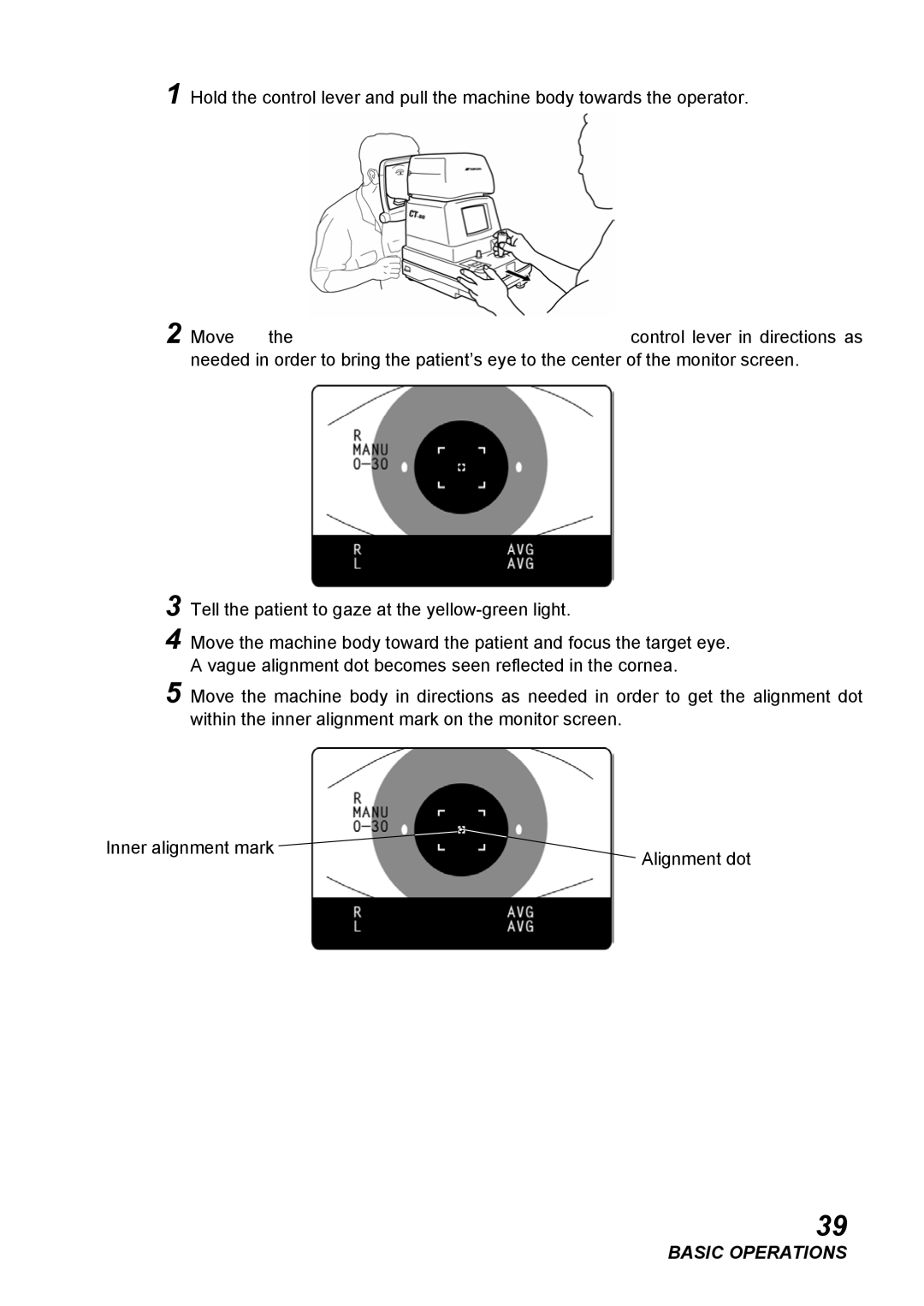 Topcon CT-80, COMPUTERIZED TONOMETER instruction manual Basic Operations 