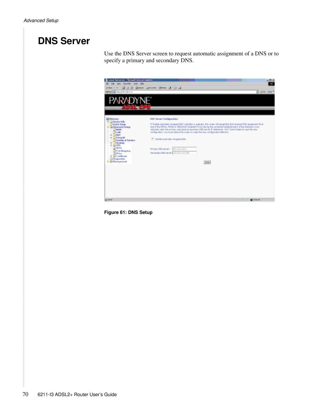 Zhone Technologies 6211-I3 ADSL2+ manual DNS Server, DNS Setup 