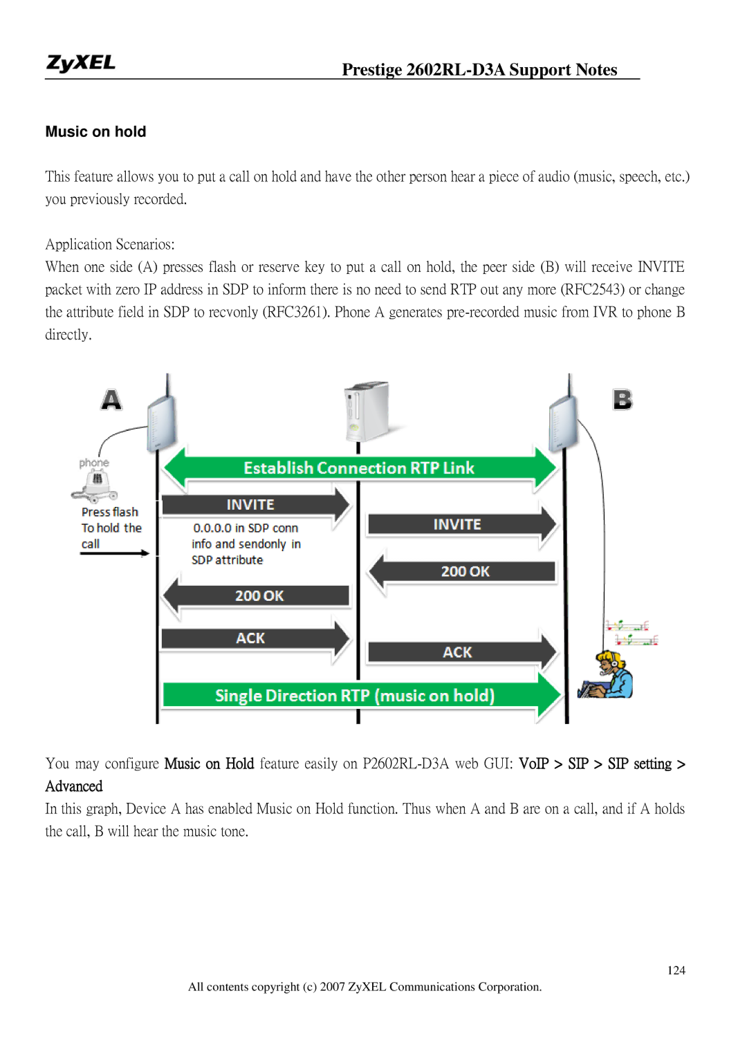 ZyXEL Communications 2602RL-D3A manual Music on hold, Advanced 