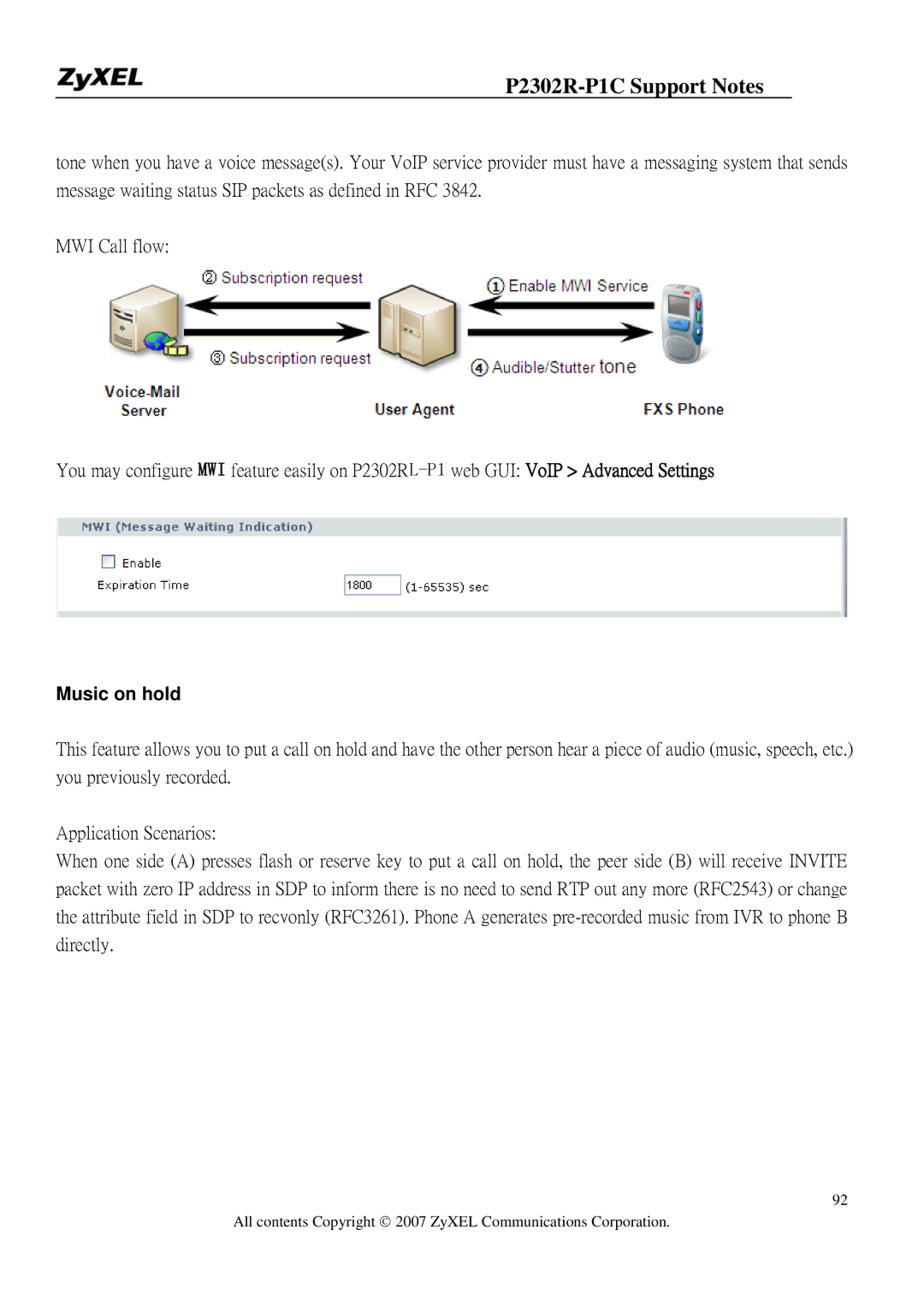 ZyXEL Communications P-2302R-P1C manual Music on hold 